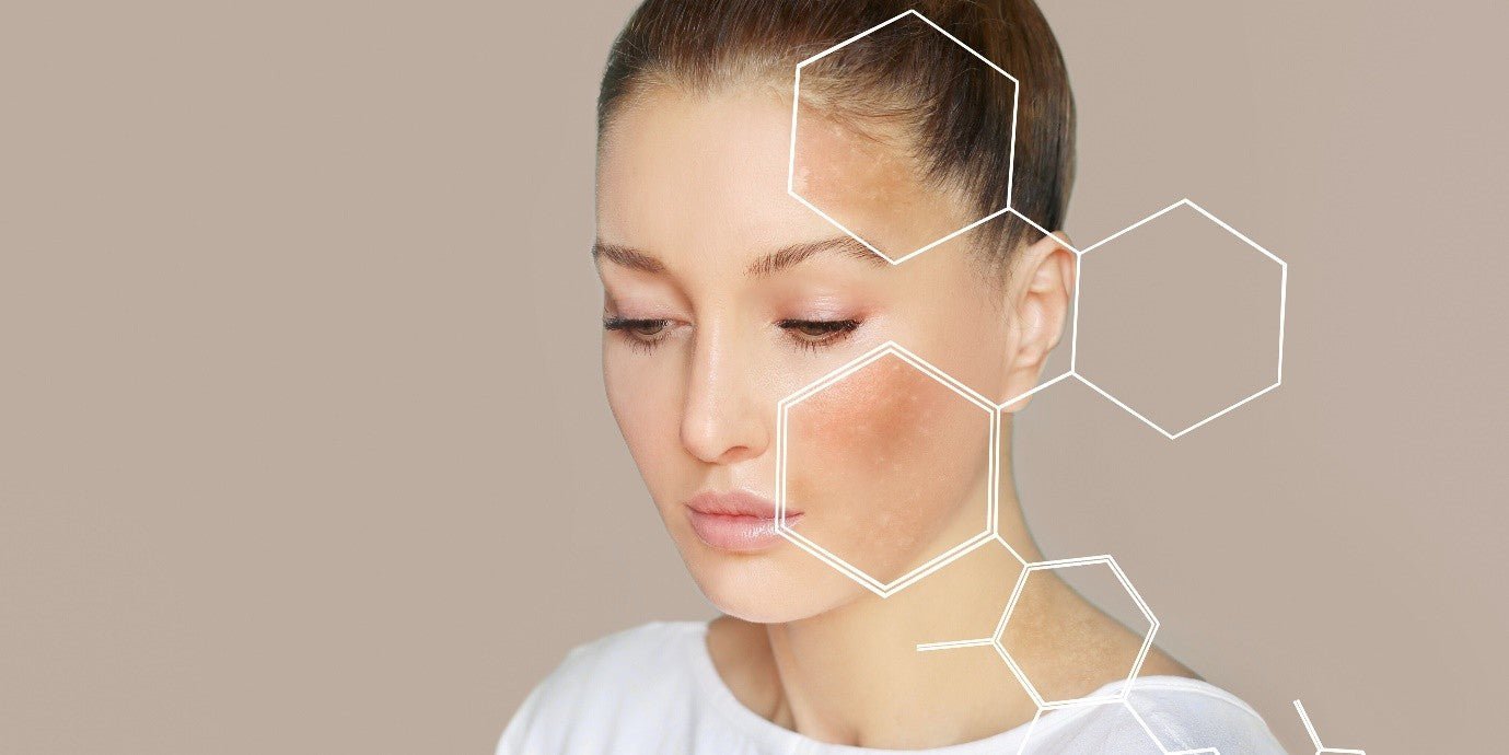 Skin Pigmentation – Impact on skin ageing and what you can do about it - Ayurscience